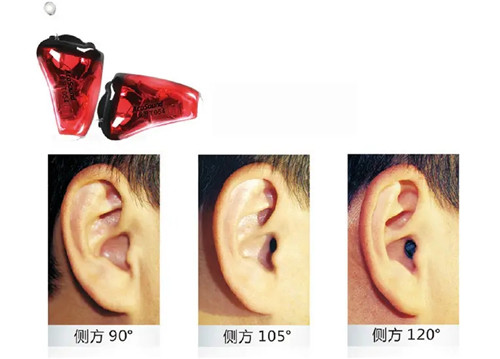 深耳道式助听器